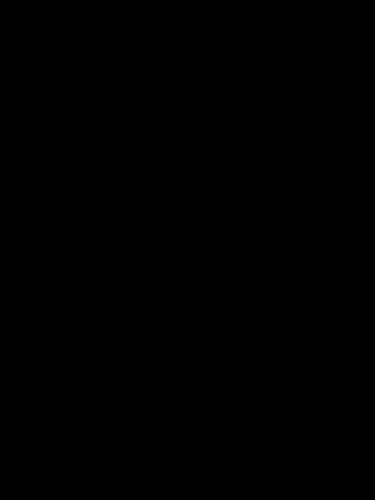 Kit calage distribution purtech